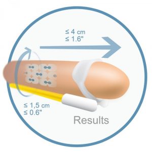 16070 ANDROEXTENDER – ANDROPENIS BASIC TRATTAMENTO PER L’INGRANDIMENTO DEL PENE